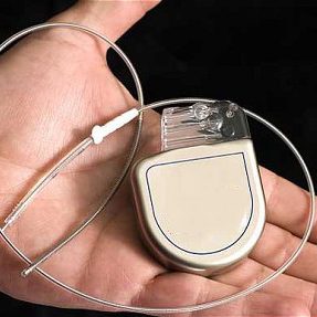 Cardioverter
