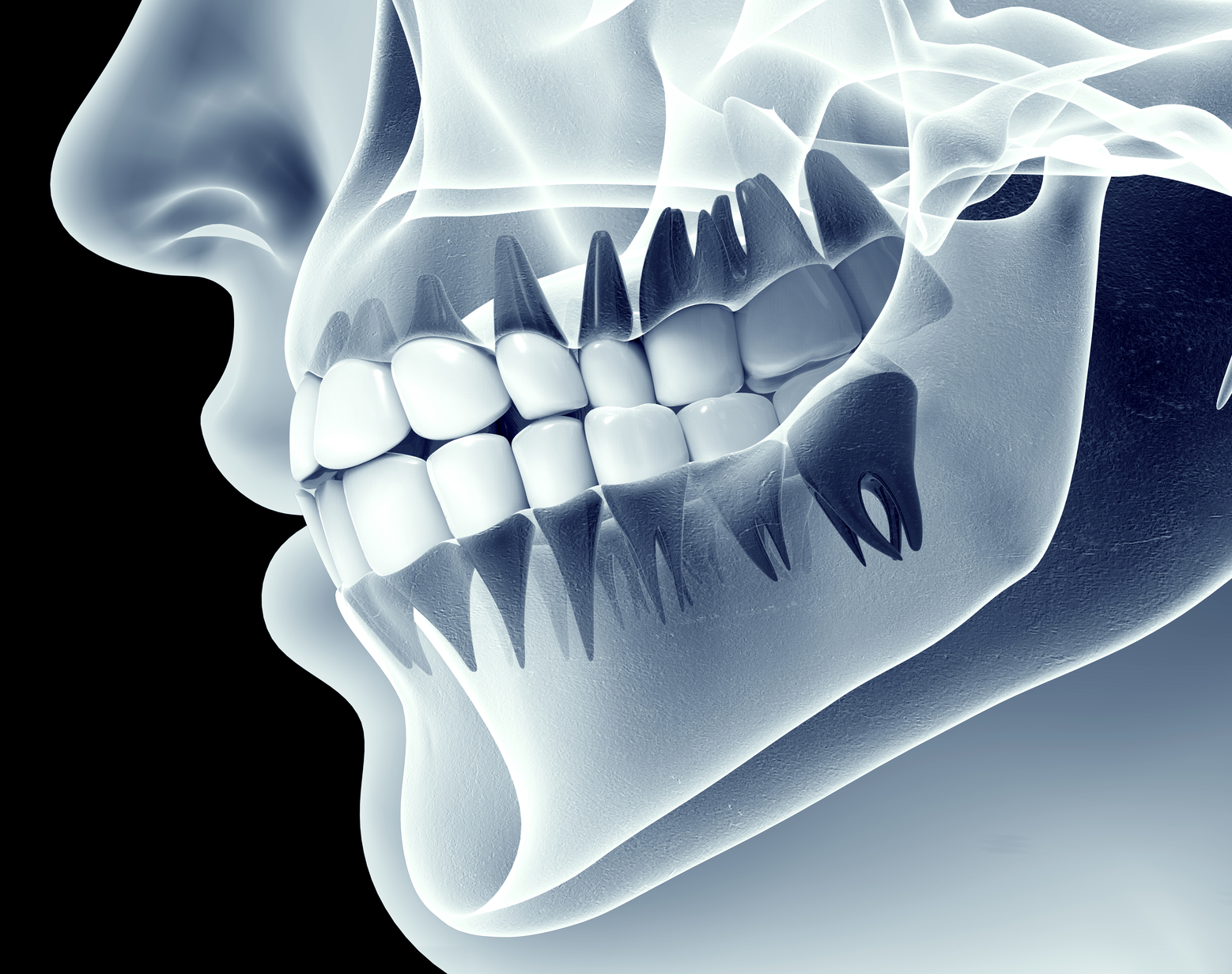 Dental X-ray
